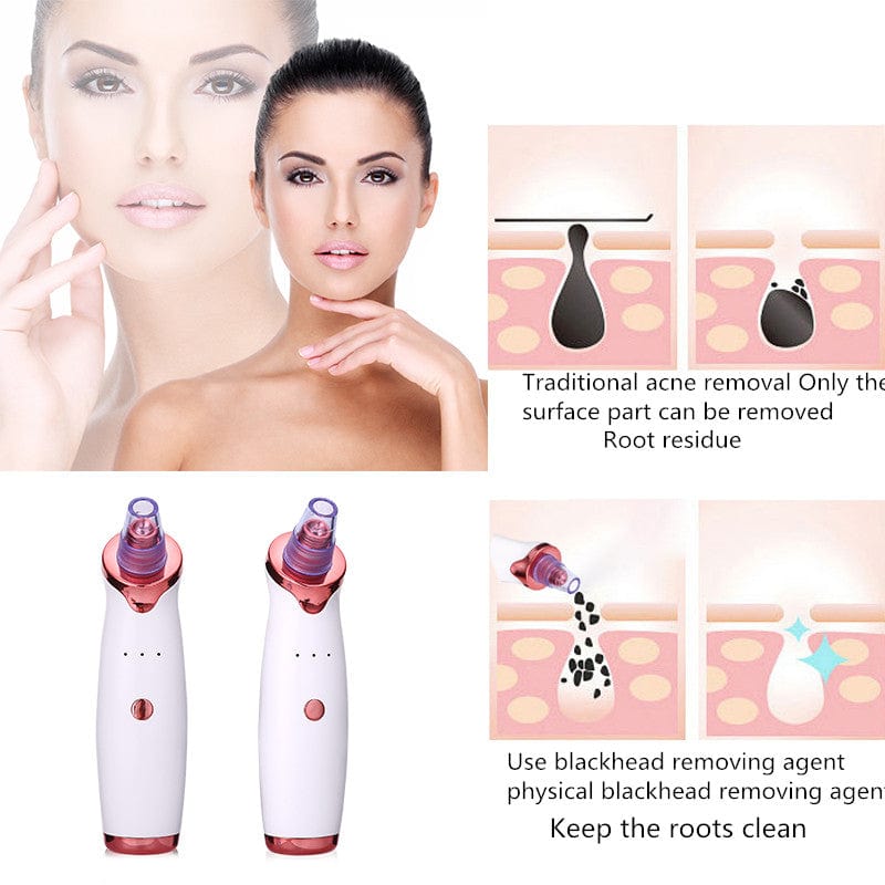 Glowupqueens.shop Facial care device default Glow Pro Skin Purifier